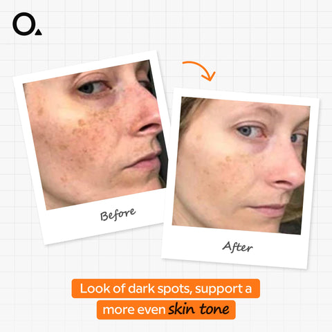 Alpha Arbutin 2% + HA