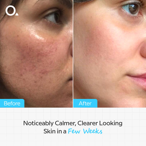 Aloe 2% + NAG 2% Solution