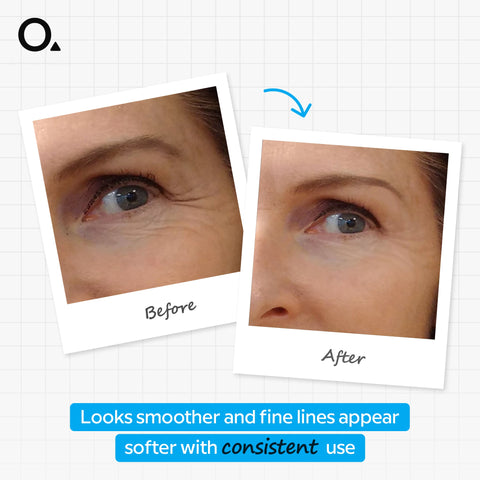 Argireline Solution 10%