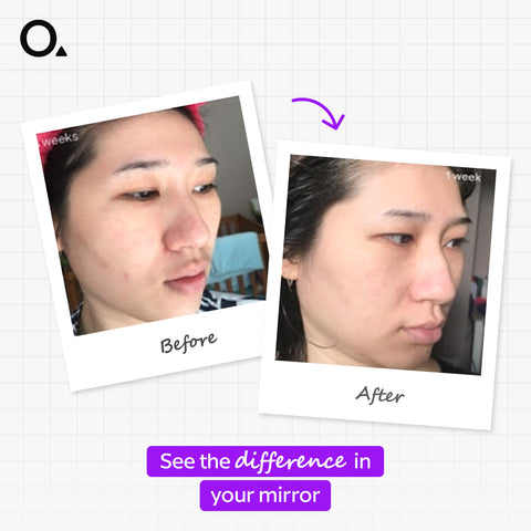 Ascorbyl Glucoside Solution 12%